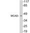 Acyl-CoA Dehydrogenase Medium Chain antibody, LS-B13447, Lifespan Biosciences, Western Blot image 