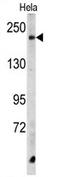 Carboxypeptidase D antibody, AP17236PU-N, Origene, Western Blot image 
