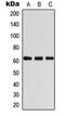 Coenzyme A Synthase antibody, LS-C353569, Lifespan Biosciences, Western Blot image 