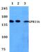 Collagen Type V Alpha 2 Chain antibody, PA5-75809, Invitrogen Antibodies, Western Blot image 