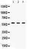 Chaperonin Containing TCP1 Subunit 4 antibody, PA5-78954, Invitrogen Antibodies, Western Blot image 