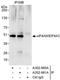 Eukaryotic initiation factor 4A-III antibody, A302-980A, Bethyl Labs, Immunoprecipitation image 