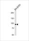 Phospholipase A2 Group IVE antibody, PA5-49553, Invitrogen Antibodies, Western Blot image 