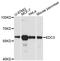 Enhancer Of MRNA Decapping 3 antibody, A13763, ABclonal Technology, Western Blot image 