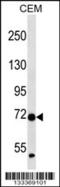 Zinc Finger Protein 443 antibody, 56-992, ProSci, Western Blot image 