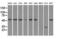 Solute Carrier Family 2 Member 5 antibody, GTX83628, GeneTex, Western Blot image 
