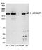 Rho GTPase Activating Protein 5 antibody, A304-549A, Bethyl Labs, Western Blot image 