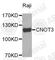 CCR4-NOT transcription complex subunit 3 antibody, A3991, ABclonal Technology, Western Blot image 