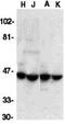 DNA Fragmentation Factor Subunit Alpha antibody, GTX31635, GeneTex, Western Blot image 