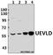 UEV And Lactate/Malate Dehyrogenase Domains antibody, A13744, Boster Biological Technology, Western Blot image 