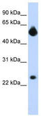Notch Receptor 4 antibody, TA329884, Origene, Western Blot image 