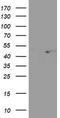 SEC14 Like Lipid Binding 2 antibody, LS-C173328, Lifespan Biosciences, Western Blot image 