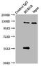 Mitotic checkpoint serine/threonine-protein kinase BUB1 beta antibody, LS-C677327, Lifespan Biosciences, Immunoprecipitation image 
