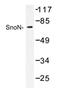 Ski-like protein antibody, AP20409PU-N, Origene, Western Blot image 
