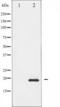 OP18 antibody, TA325916, Origene, Western Blot image 