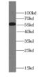 STEAP2 Metalloreductase antibody, FNab08317, FineTest, Western Blot image 