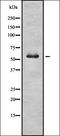Glucosylceramidase Beta antibody, orb337124, Biorbyt, Western Blot image 