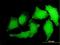 S100 Calcium Binding Protein A2 antibody, H00006273-M06, Novus Biologicals, Immunocytochemistry image 