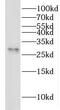 YEATS domain-containing protein 4 antibody, FNab03351, FineTest, Western Blot image 