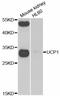 Uncoupling Protein 1 antibody, STJ28420, St John