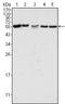 P21 (RAC1) Activated Kinase 2 antibody, A01419-1, Boster Biological Technology, Western Blot image 