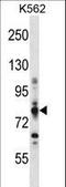 Carnitine Palmitoyltransferase 1A antibody, LS-C167008, Lifespan Biosciences, Western Blot image 