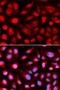 Ribosomal Protein L5 antibody, orb136255, Biorbyt, Immunofluorescence image 