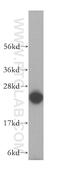 Potassium Channel Tetramerization Domain Containing 5 antibody, 15553-1-AP, Proteintech Group, Western Blot image 