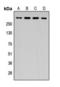 APC Regulator Of WNT Signaling Pathway antibody, orb393207, Biorbyt, Western Blot image 