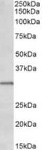 Insulin Like Growth Factor Binding Protein 1 antibody, TA320205, Origene, Western Blot image 