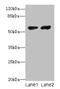 Cyp17 antibody, CSB-PA006392LA01HU, Cusabio, Western Blot image 