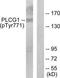 Phospholipase C-gamma-1 antibody, TA313084, Origene, Western Blot image 