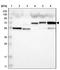 Family With Sequence Similarity 189 Member B antibody, NBP1-88343, Novus Biologicals, Western Blot image 