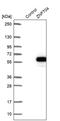 Zinc finger protein 704 antibody, PA5-55038, Invitrogen Antibodies, Western Blot image 
