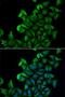 Fatty Acid Binding Protein 5 antibody, LS-C334668, Lifespan Biosciences, Immunofluorescence image 