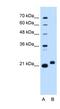 Chromosome 1 Open Reading Frame 159 antibody, NBP1-91307, Novus Biologicals, Western Blot image 