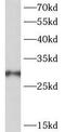 Proteasome Assembly Chaperone 2 antibody, FNab06899, FineTest, Western Blot image 