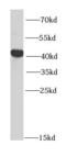 PTPN2 antibody, FNab06935, FineTest, Western Blot image 