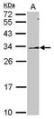 N(G),N(G)-dimethylarginine dimethylaminohydrolase 2 antibody, PA5-30684, Invitrogen Antibodies, Western Blot image 