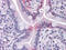 Fatty Acid Binding Protein 2 antibody, M02378, Boster Biological Technology, Immunohistochemistry paraffin image 