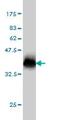 NPC Intracellular Cholesterol Transporter 1 antibody, ab55706, Abcam, Western Blot image 