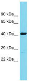 Abhydrolase Domain Containing 18 antibody, TA330765, Origene, Western Blot image 