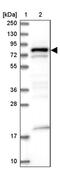 DENN Domain Containing 1C antibody, PA5-60144, Invitrogen Antibodies, Western Blot image 