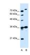 Solute Carrier Family 9 Member A7 antibody, NBP1-62455, Novus Biologicals, Western Blot image 