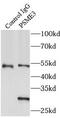 Proteasome activator complex subunit 3 antibody, FNab06896, FineTest, Immunoprecipitation image 