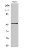 Hepatocyte Nuclear Factor 4 Alpha antibody, STJ93555, St John