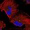 Regulator Of Microtubule Dynamics 1 antibody, PA5-55321, Invitrogen Antibodies, Immunofluorescence image 