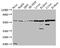 Aldehyde Dehydrogenase 7 Family Member A1 antibody, CSB-PA001579LA01HU, Cusabio, Western Blot image 
