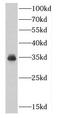 Cyclin Dependent Kinase 5 antibody, FNab01558, FineTest, Western Blot image 