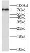 Nuclear Receptor Subfamily 1 Group D Member 2 antibody, FNab05833, FineTest, Western Blot image 